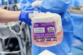 猪器官移植时代正在到来？美国批准史上首个移植试验图片