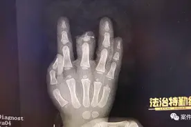 事发上海一商场！19个月女童被扶梯夹断手指！双方互相指责，法院判了！图片