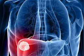 身体发出这2个声音，多半是肝在求救！很多人还以为只是肠胃不舒图片