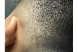 如何洗头发去屑去油?男士控油去屑效果好的洗发水排行榜图片