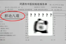 肝功能检查报告，主要看懂3个指标图片