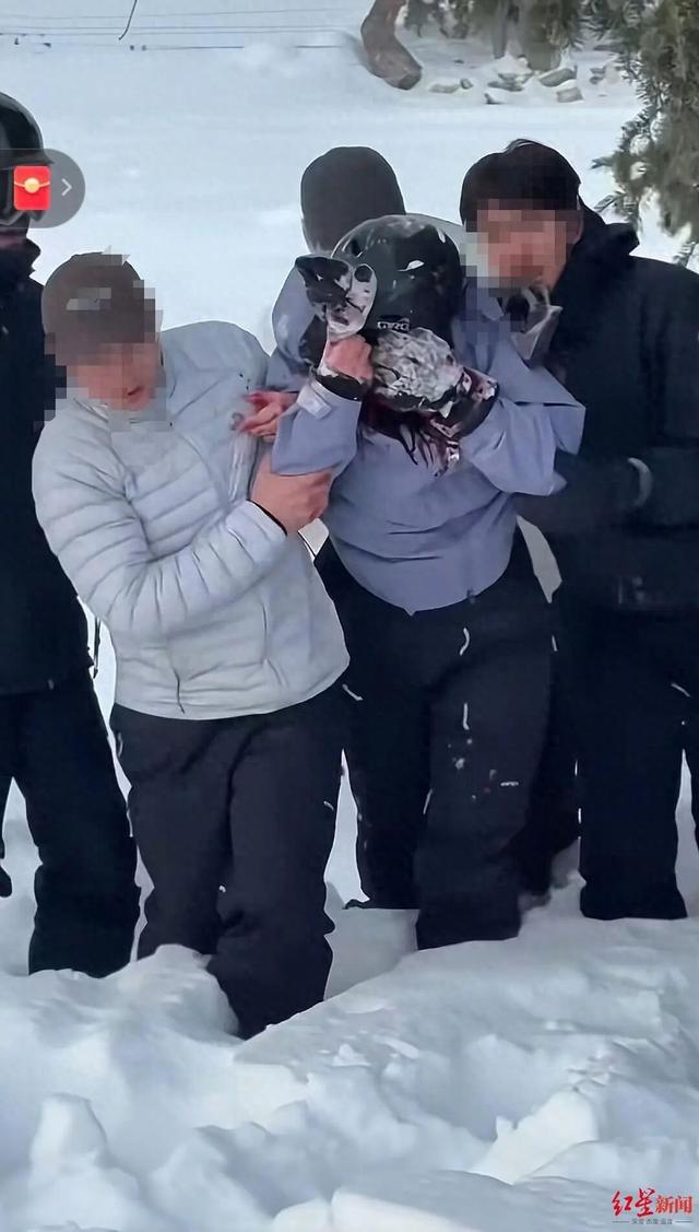 被雪豹咬伤女子已从急诊转至其他科室，目击者称“当事人没有去摸豹子”，专家：雪豹当时或在“应激”状态