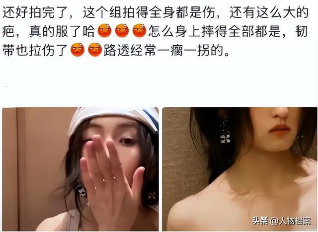 张子枫丝巾裹胸，曝浑身伤痕胸前、手臂都有，才懂成龙话的含金量