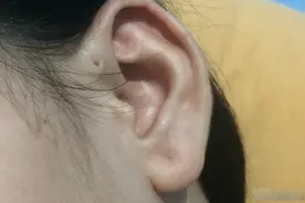 10种罕见的人体特征，拥有一个或是“天选之人”，看你占了几种？图片