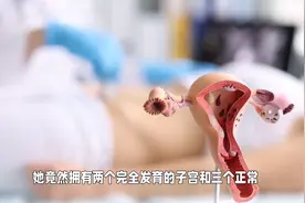 本身还是双胞胎！7岁小女孩天生2个子宫3个肾图片