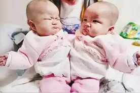 女子产下中国“首例连体婴儿”，成功分离14年后，现状让人感慨图片