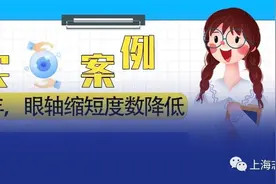 真实案例丨戴OK镜一年眼轴缩短度数降低！！图片