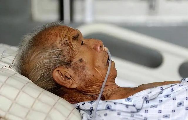 离死亡最近的3个月，肿瘤患者会出现5个症状，希望你一定都没有！