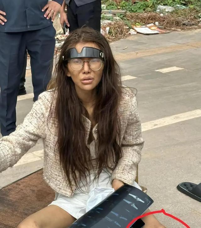 流落柬埔寨的吴某桢，疑似腿摔断染上病，已成废人，知情人曝更多