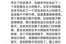 误打误撞把病给治好了是一种什么样的体验？网友：真是无巧不成书图片