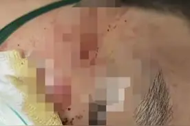 江西理工老外殴打中国学生后续：当事人发声，警方介入，网友愤怒图片