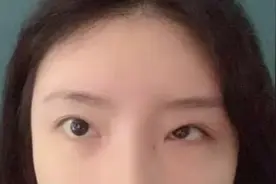 单眼失明女孩自述图片