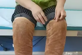 大夏天上半身直冒汗，下半身却必须穿棉裤……60多岁大姐一个身体仿佛分成“两截”图片