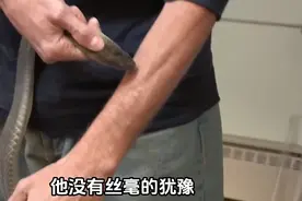 美国男子被毒蛇咬200多次，以身试毒18年，血液竟出现广谱抗体图片