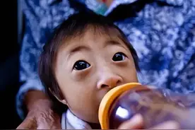 09年湖南产妇生下“猴孩”，曾被杂技团出5万想买走，现在怎样了图片