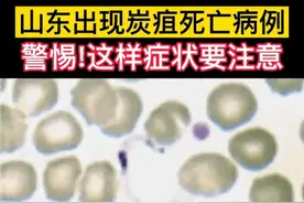 惊呆了，山东5人被诊断为皮肤炭疽已隔离，评论区炸锅了。图片