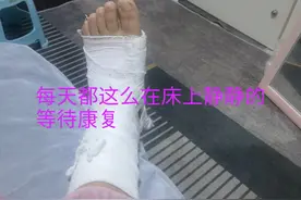 距骨骨折保守治疗的七十六天，不知还需多久才能康复走路，期待中图片