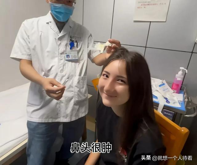 法国四姐女儿瓦尼萨鼻子拆线纱布揭掉了 看看手术前后的对比图吧！