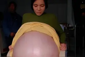 女子怀孕36月却还没生，肚重60公斤惨遭丈夫抛弃，医生：还有救!图片