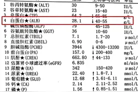 肝硬化患者缺失的白蛋白该怎么补充好呢？听听医生的详细解答图片
