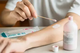 几块钱一瓶的炉甘石洗剂，连世卫组织都推荐，可以治疗6种皮肤病.图片