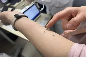 发病后急剧恶化，男子差点窒息！近期高发，很难根治！张文宏发声图片