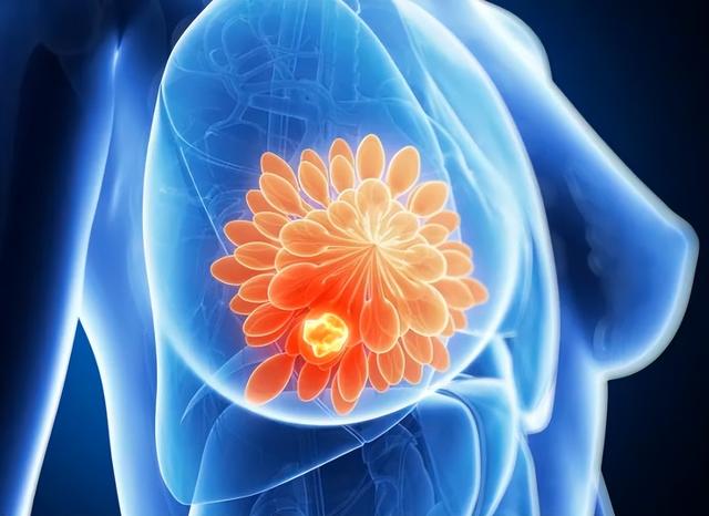 乳房胀痛是正常生理期？提醒：若出现这2种情况，可能是疾病信号