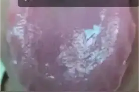 都是化瘀猛将，血府逐瘀丸、桂枝茯苓丸究竟有什么区别？一次讲清图片