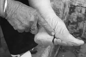 缠足是从哪个朝代开始的图片