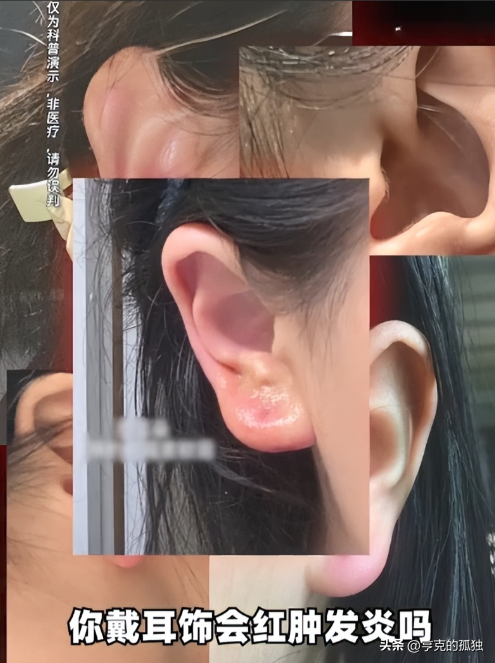 致癌物超标1179倍，造假率超过75%，很多人天天用，孩子也爱戴