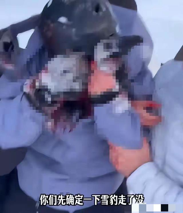 雪豹咬伤后续！女游客很漂亮，已经毁容，知情人曝内幕	，被咬不冤