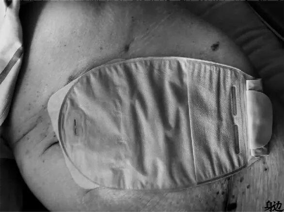 宿舍里的护工姐妹，为了海王大打出手|擦拭夕阳（中）