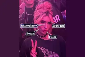 梅根福克斯现在怎么整成这样了？网友：性感女神脸蛋全浪费…图片