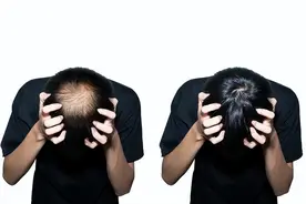 脂溢性脱发的根源是湿热，一个方子清热利湿，疏通全身顺畅运行图片