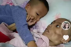 全网心疼！4岁男孩一遍遍呼唤癌症晚期母亲，丈夫称妻子一个多月暴瘦40斤图片