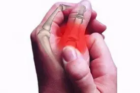 腱鞘炎是筋伤留下的痛，活血止痛是上策，一个中成药可止！图片