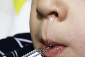 太子参4种搭配，脾肺强壮，免疫力强了，不怕鼻炎腺样体肥大了图片
