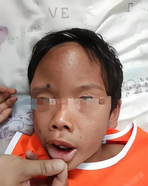 快扔掉！廉价手机壳铅超标30倍，可破坏骨骼，甚至影响下一代发育