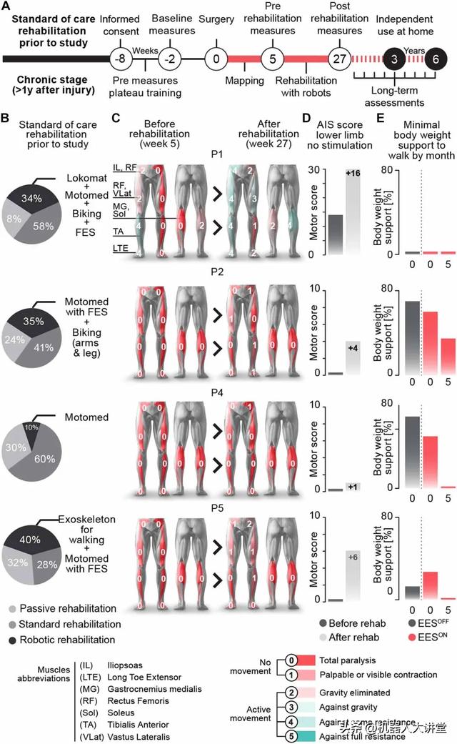 让瘫痪患者重新行走！脊髓电刺激+康复机器人 | Science子刊