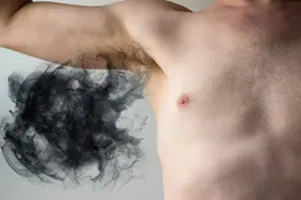 腋臭很烦人影响恋爱和工作，你知道是怎么回事吗？医生分析一下图片