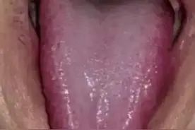 为什么说“红舌不补阳，白舌不滋阴”？看完此篇，你就明白了！图片