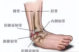 【健康科普】踝关节扭伤，怎么办？别急，骨科医生教你快速处理~图片