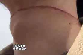 险些被“割喉”！春季骑行，警惕空中的“隐形刀”图片