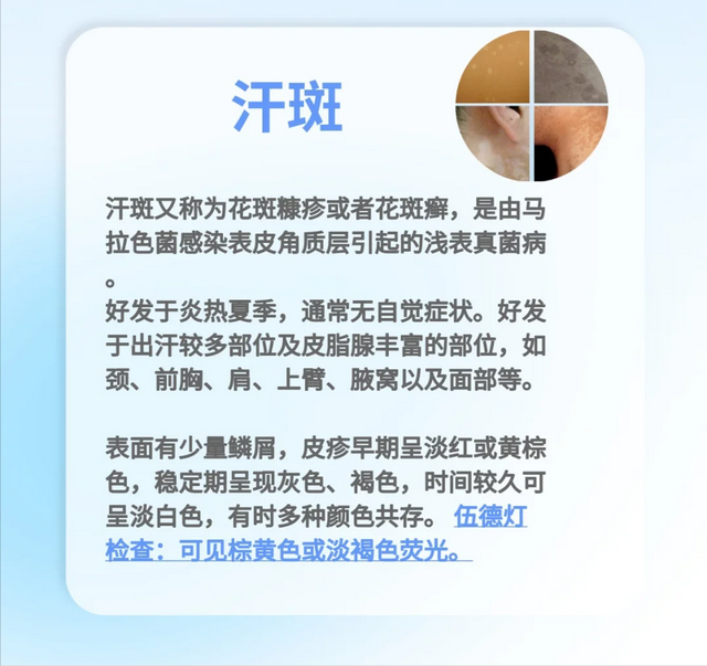 白癜风与汗斑如何分辨？3 大差异 + 自测法，一文搞懂
