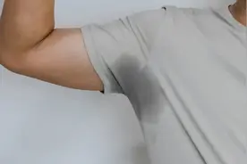 一出汗腋下就有味，「腋臭」能根治吗？图片