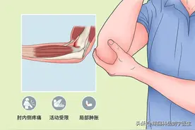 我为什么得高尔夫球肘？图片