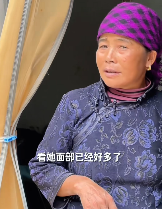 云南大姨被蜜蜂狂蜇，满脸蜂刺求助，过路司机惊呆，网友直呼惊险