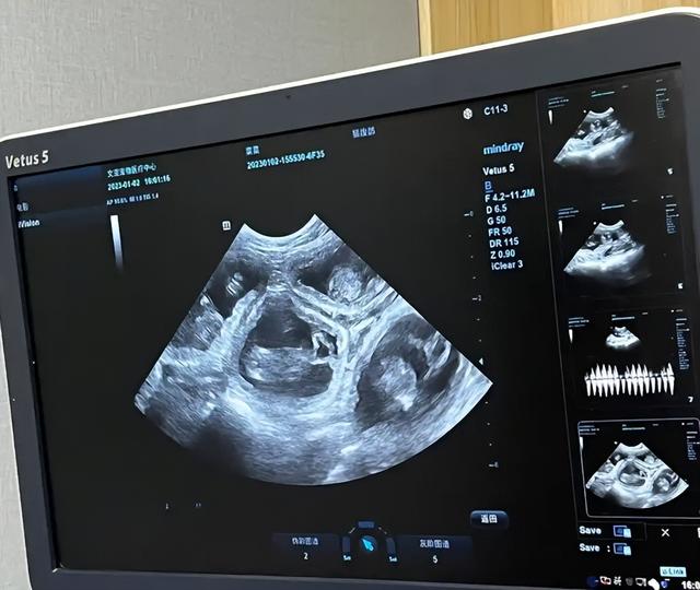 “生不起”或成历史，2026生娃基本不花钱，每月还能领补贴