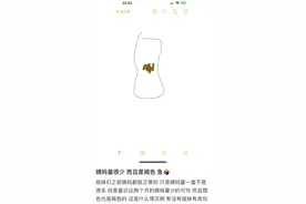 月经前出现褐色分泌物是怎么回事？医生解答来了！图片