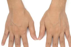 手背血管能看出寿命长短？医生：血管若有这些特征，恭喜你很健康图片